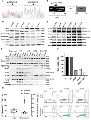 Mitochondrial chaperon TNF-receptor- associated protein 1 as a novel apoptotic regulator conferring susceptibility to Pneumocystis jirovecii pneumonia